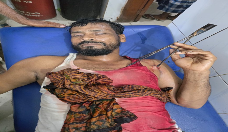 গজারিয়ায় পৃথক সংঘর্ষ ও হামলায় টেঁটাবিদ্ধসহ আহত ৯.